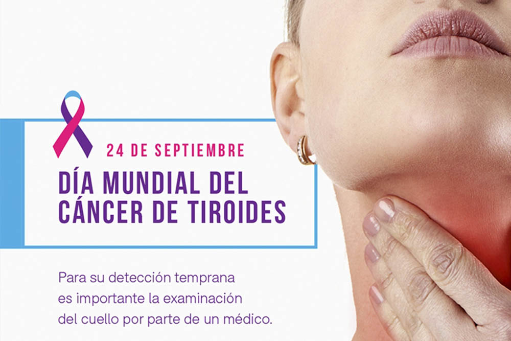 cancer de tiroides