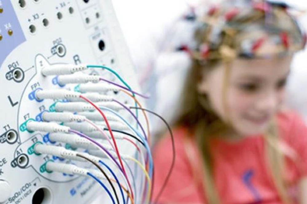 epilepsia infantil